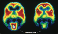 A series of two PET scans. A scan was done when the volunteer’s eyes were either open (left) or ...