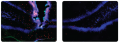 Increased neurogenesis in the dentate gyrus following damage. The left panel shows (1) an ...