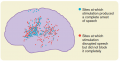 The wide distribution of left hemisphere sites where cortical stimulation either blocked speech or ...