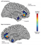 Structural MRIs of healthy volunteers with a genetic predisposition to developing depression reveals ...