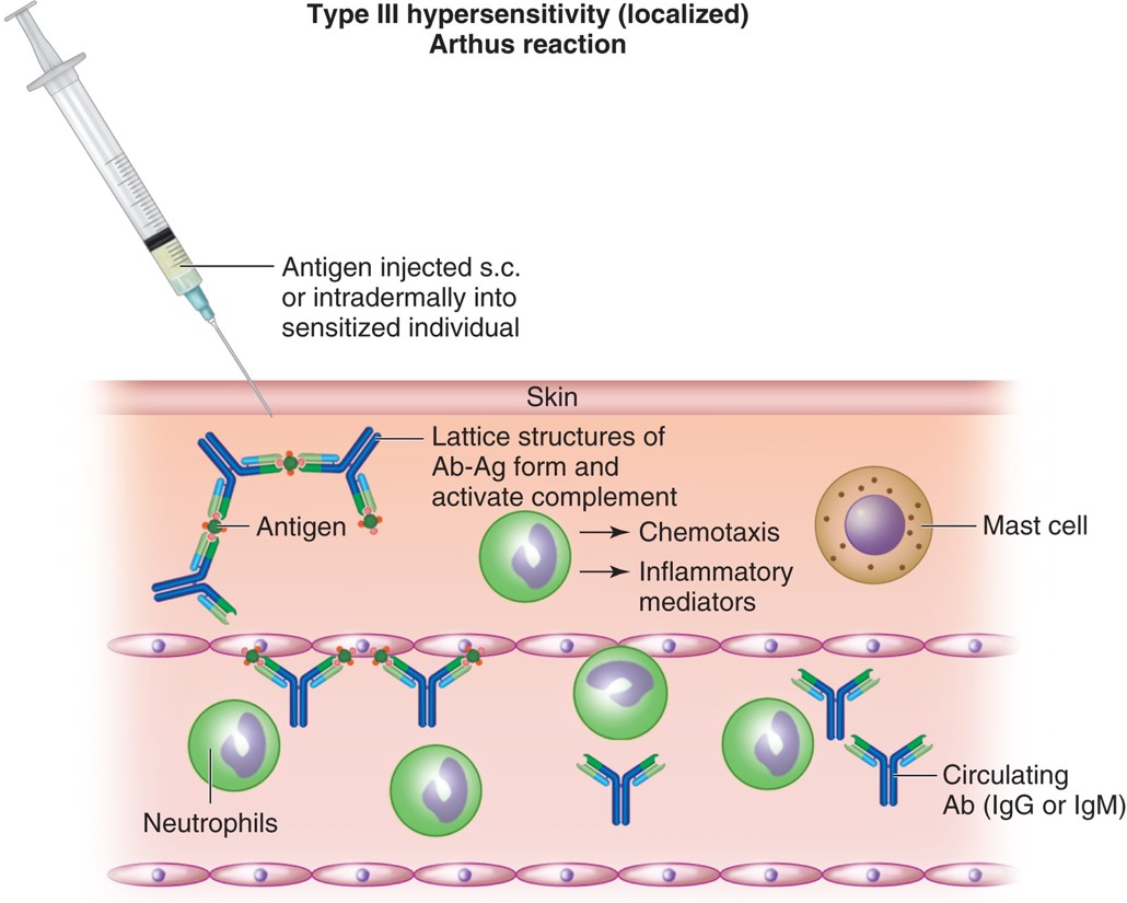 Immunologic and inflammatory mechanisms of the Arthus reaction.