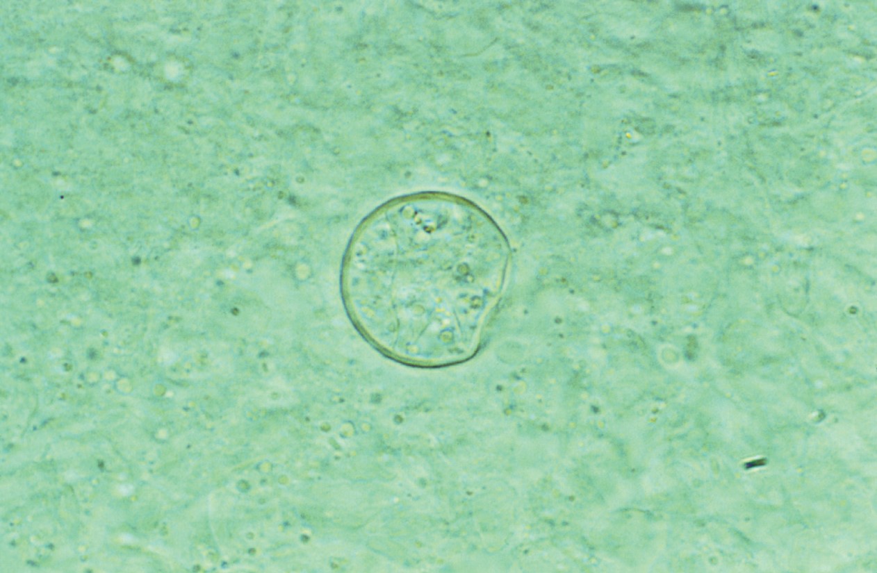 Chlamydospore or spherule that occurs at body temperature.