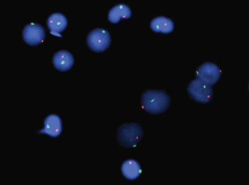 Fluorescence in situ hybridization (FISH) is a cytogenetic technique that is used to detect the ...