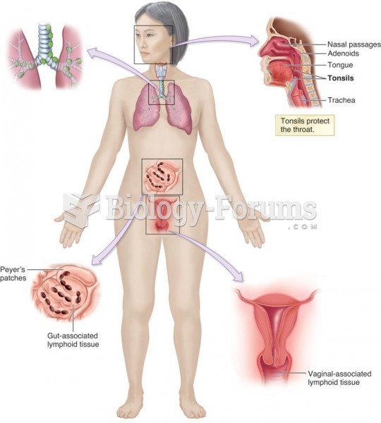 Mucosa-associated lymphoid tissue (MALT), including tonsils, adenoids, and gut-associated lymphoid ...