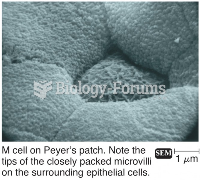 Mucosa-associated lymphoid tissue (MALT), including tonsils, adenoids, and gut-associated lymphoid ...