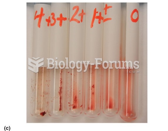 (c) A photograph of a hemagglutination reaction. In the tube labeled 0, there is no agglutination, ...