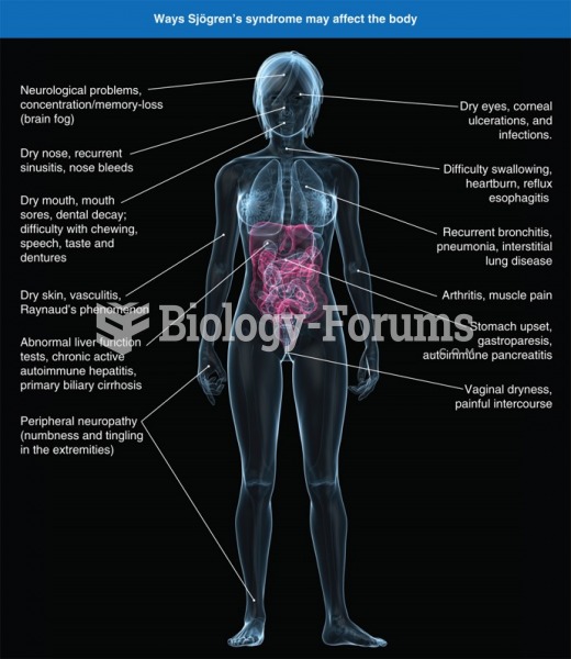 Physical features of Sjögren's syndrome. Source: Ways Sjogren's Syndrome May Affect the ...