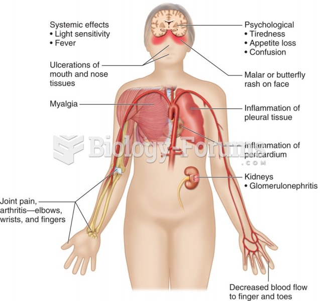 Most common symptoms of systemic lupus erythematosus (SLE).