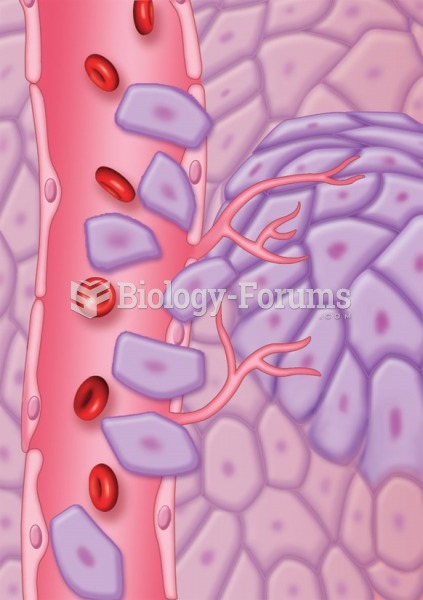 Metastatic process: Tumor leaving primary site to travel to other distant organs to grow.