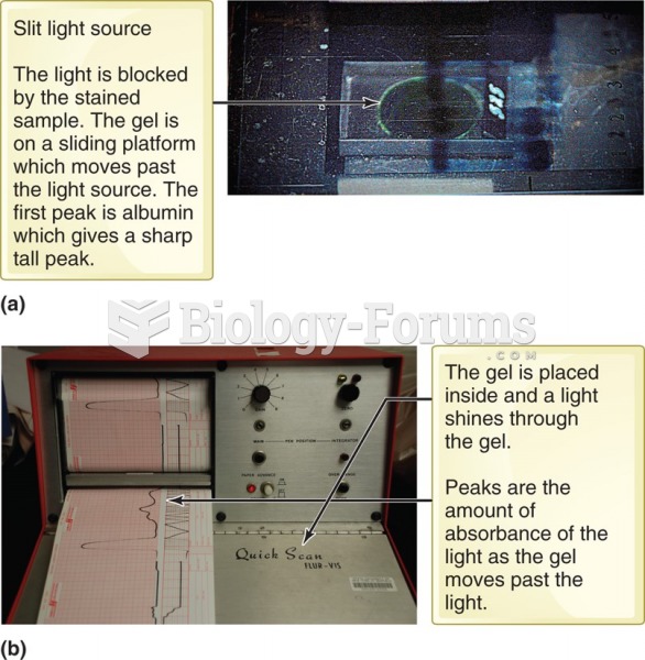 Electrophoresis gel in a densitometer. (a) The green light from the slit light source is visible ...