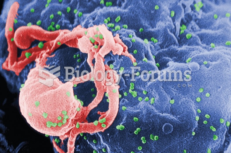 Scanning electron micrograph of HIV-1 budding (in green) from cultured lymphocyte. This image has ...