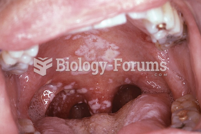 Oral pseudo membraneous candidiasis in a patient with AIDS. 