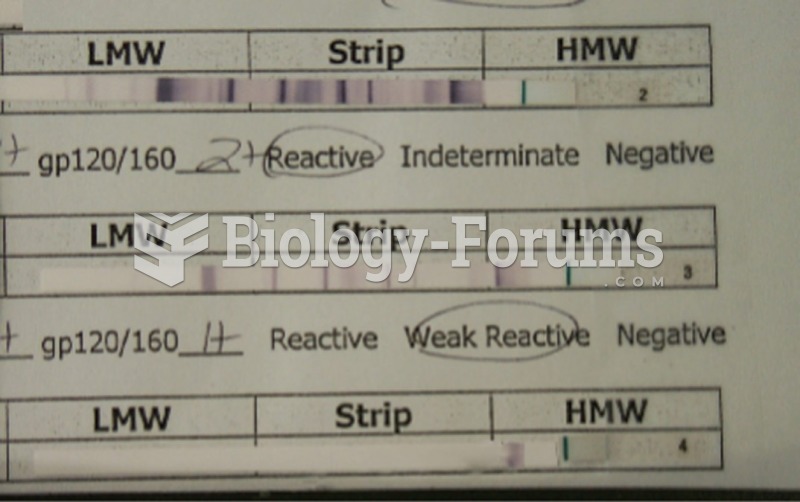 Western blot analysis of viral antigens. The nitrocellulose strips from the kit contain blotted ...