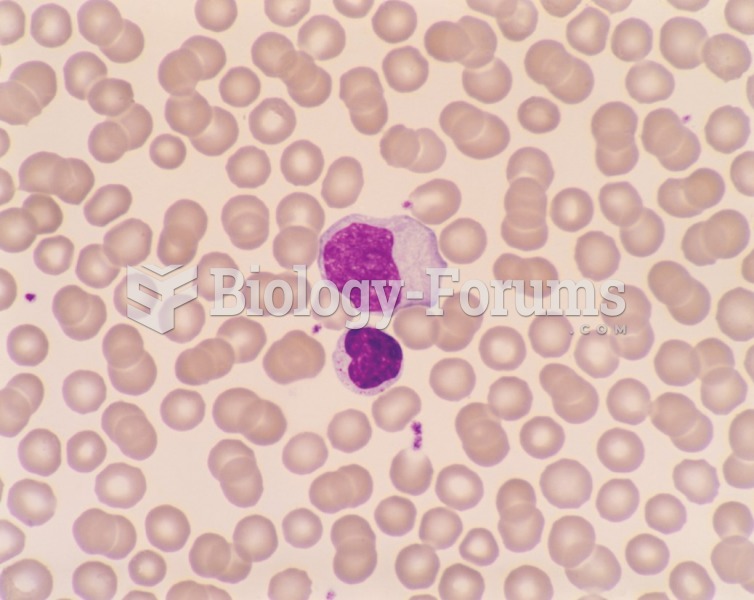 Two lymphocytes that are reactive in a 19-year-old college student with infectious mononucleosis. ...