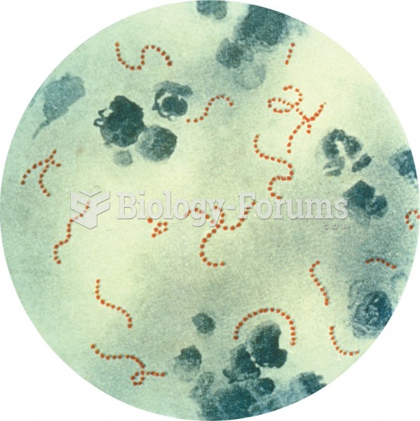 Photomicrograph of Streptococcus pyogenes bacteria, 900x Mag. A pus specimen, viewed using ...