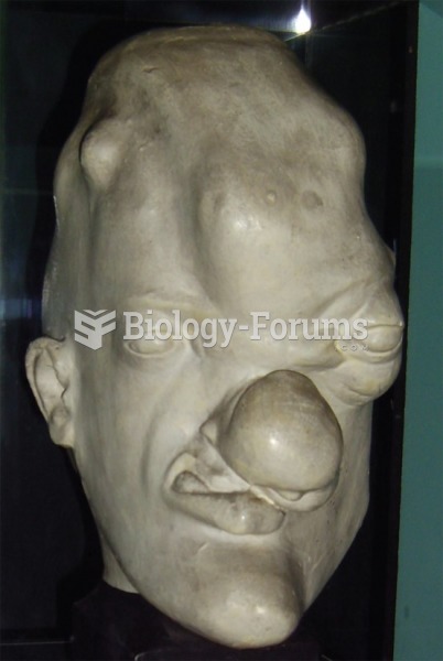 Head of a patient with tertiary syphilis.