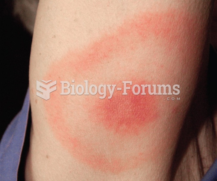 Erythematous rash in Lyme disease in the pattern of a "bull's-eye" at the site of ...