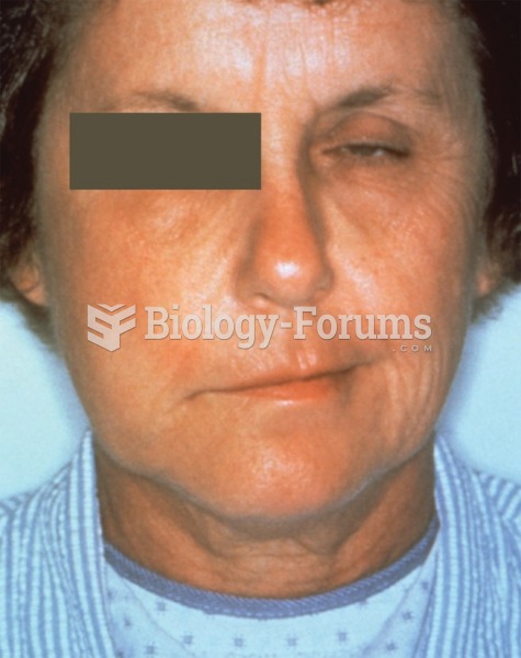 This patient presented with a case of facial palsy caused by an infection by the bacterial ...