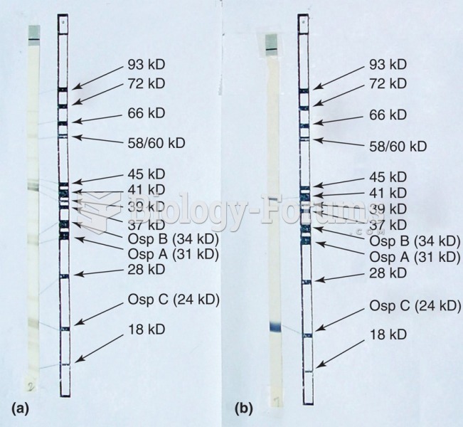 Western blot patterns for different Borrelia antigens: (a) IgG Western and (b) IgM Western.