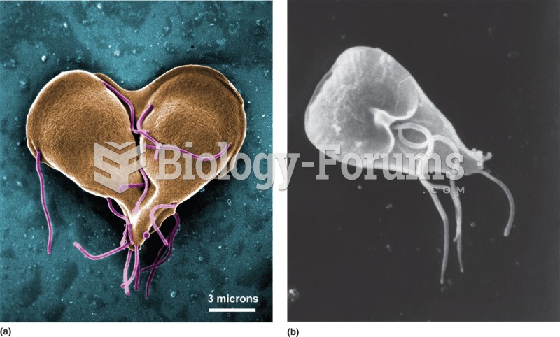 (a) Giardia lamblia protozoan as it is replicating. (b) Scanning micrograph.