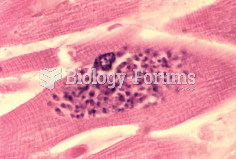 Toxoplasma gondii in the heart of an HIV patient. 