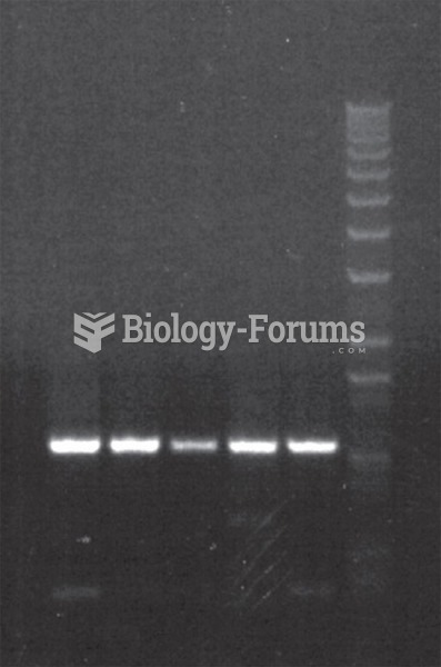 Simple amplification of 1kb DNA fragments by polymerase chain reaction.
