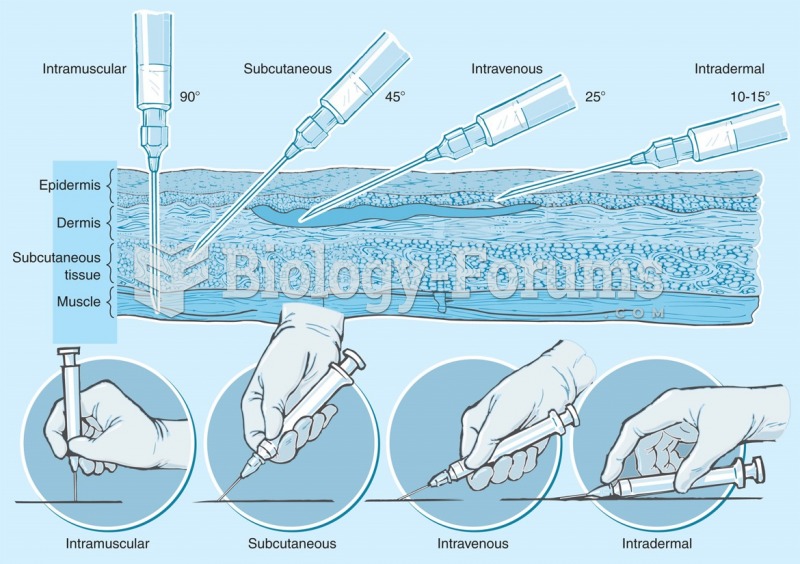 Different routes of parenteral drug administration.