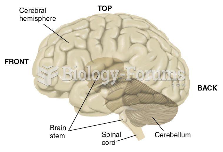 A View of the Left Side of the Brain