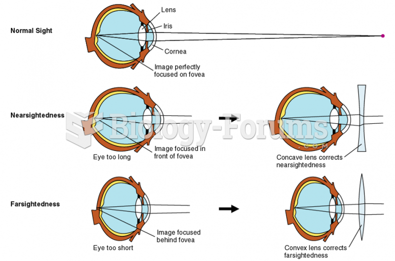 The Eye and Its Functions