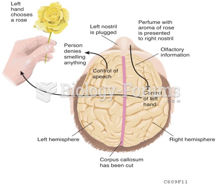 The Split-Brain Syndrome