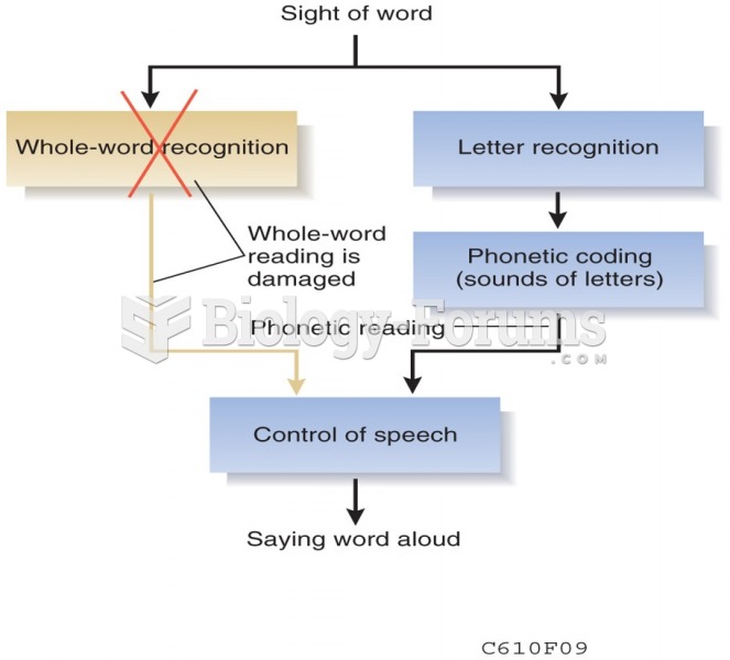 A Model of Surface Dyslexia