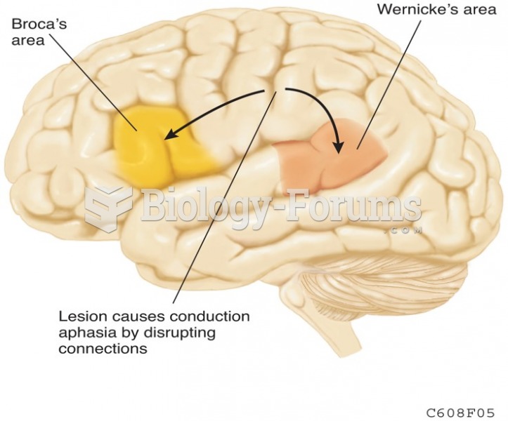 Diagram Showing How Conduction Aphasia is Caused