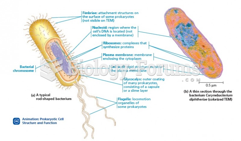 A prokaryotic cell