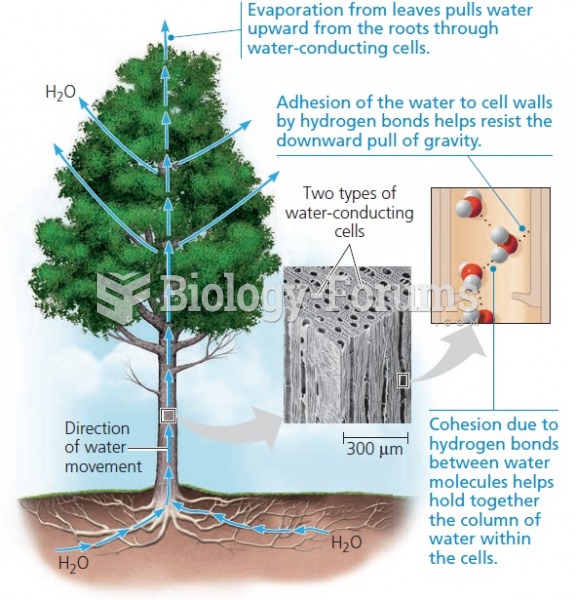 Water transport in plants