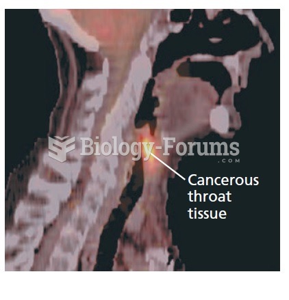 A PET scan, a medical use for radioactive isotopes.