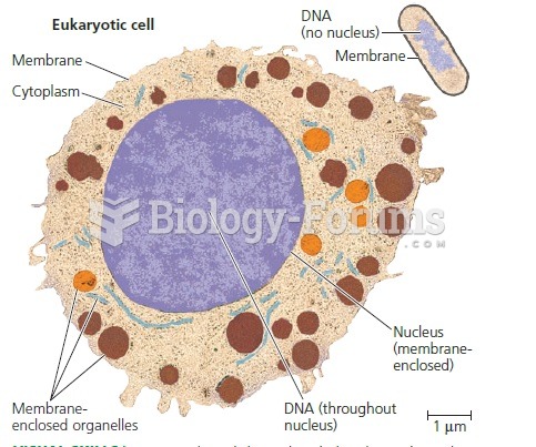 Contrasting eukaryotic and prokaryotic cells in size and complexity