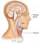 Thyroid hormone production—Relationship between pituitary and thyroid glands. Thyroid hormone ...