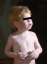 Rubella rash in a young child. Rubella is also called 3-day measles or German measles. 