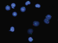 Fluorescence in situ hybridization (FISH) is a cytogenetic technique that is used to detect the ...