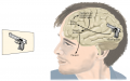 Hypothetical Exchanges of Information within the Brain of a Patient with Visual Agnosia