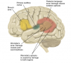 Locations of Broca’s Area, Wernicke’s Area, and Associated Areas Involved in Language Deficits