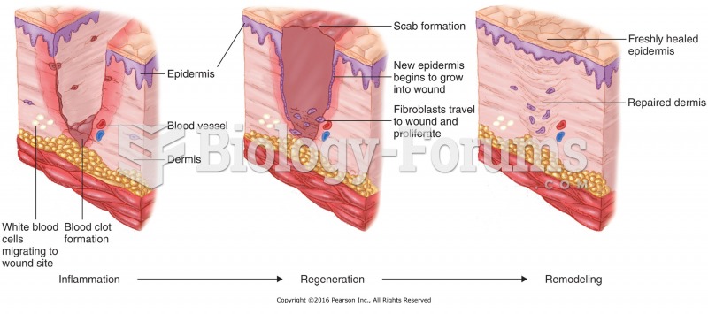 Three Phases of the Tissue/Wound Repair Process.