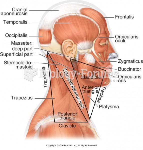 Anterior and posterior triangles of the neck. Avoid massage in anterior neck.