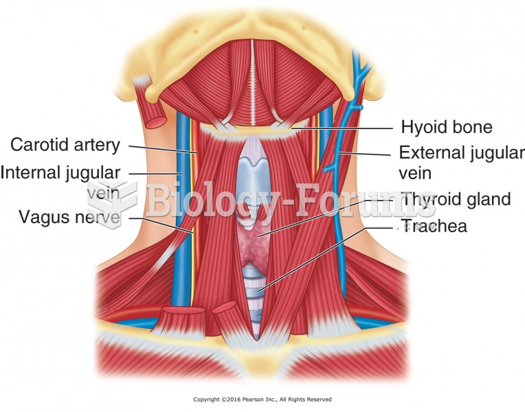 Anterior neck structures. Avoid massage in anterior neck.