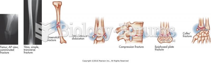 Types of fractures. Massage is contraindicated near fractures in early stages of healing.