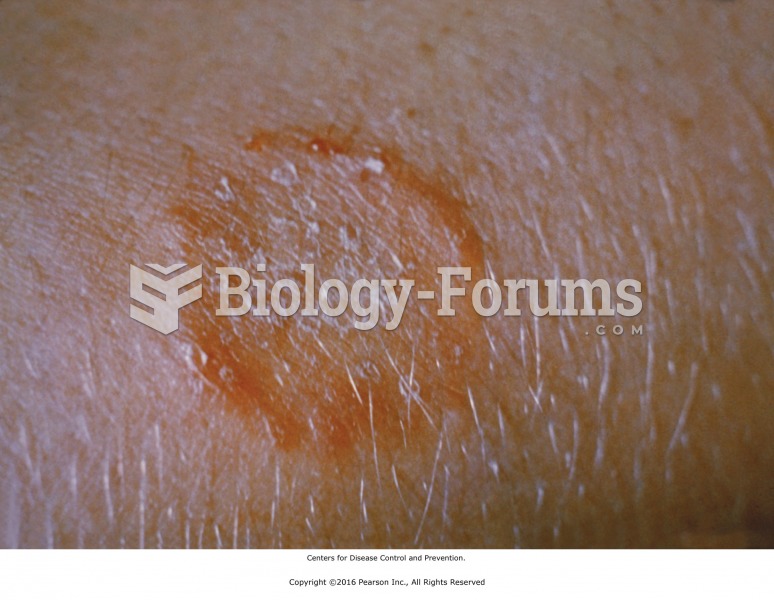 Ringworm is a local contraindication for massage. Centers for Disease Control and Prevention.