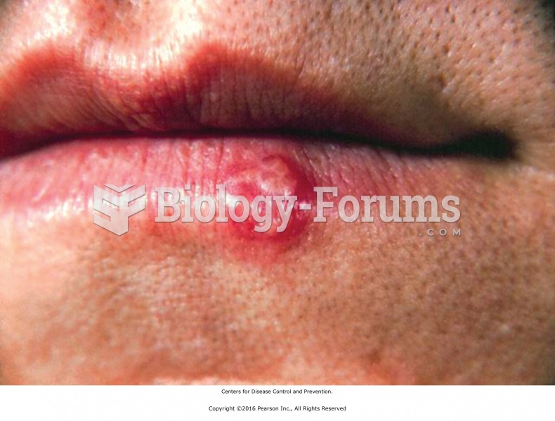 Herpes is a local contraindication during active phase.