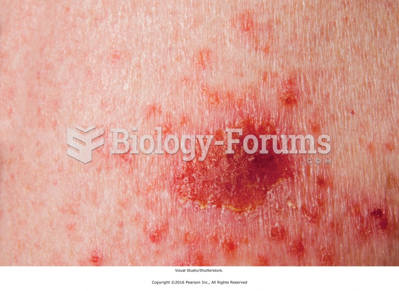 Basal cell carcinoma is a local contraindication for massage.