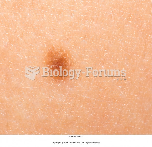 A common mole (nevus) is not a contraindication for massage.