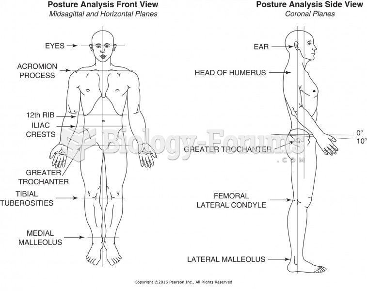 Reference points for posture analysis.